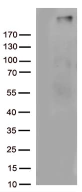 Monoclonal Mouse anti-Human Complement C4b Antibody (clone OTI1B2, Carrier-free, aa1100-1350, WB)