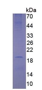 Human SHBG Protein (Recombinant His, N-Terminal)