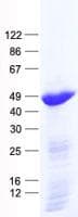 Human HAO1 Protein (Recombinant His, N-Terminal)