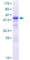 Human RCD1 / RQCD1 Protein (Recombinant GST)