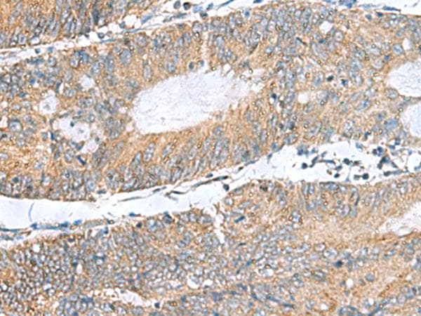 Polyclonal Rabbit anti-Human NFKB1 / NF-Kappa-B Antibody (IHC)