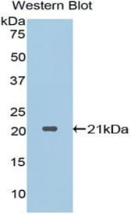 Polyclonal Rabbit anti-Human PRTN3 / Myeloblastin Antibody (aa71-247, WB)