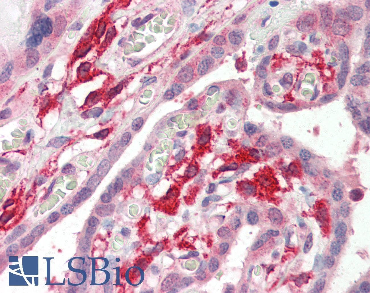 IHC-plus™ AIF1 / IBA1 Antibody (aa138-148)