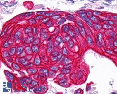 PathPlus™ Prostaglandin D2 Receptor Antibody (Extracellular Domain)