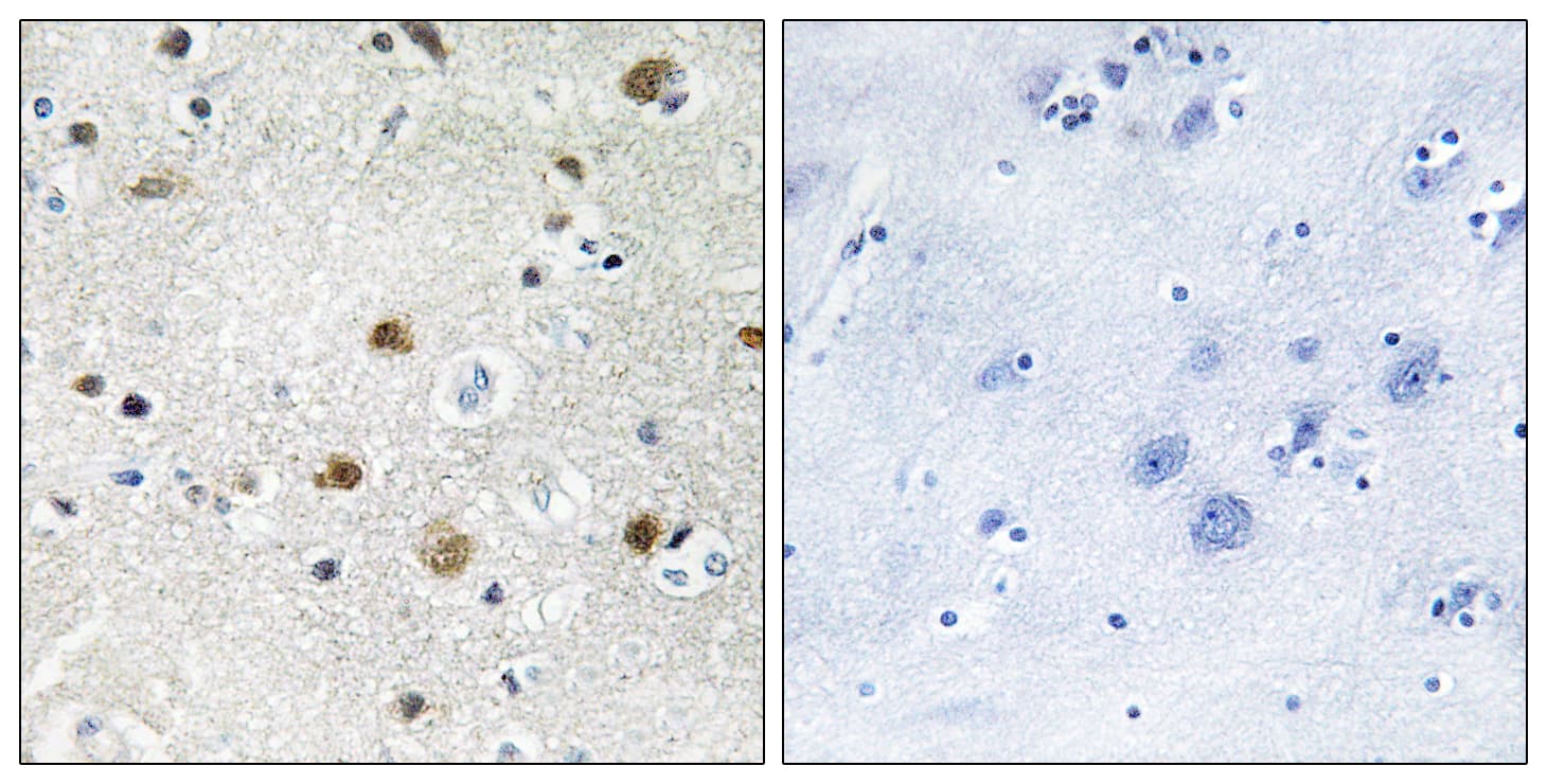 Polyclonal Rabbit anti-Human BRF1 Antibody (aa231-280, IHC, IF, WB)
