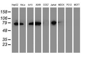 PDIA4 / ERP72 Antibody (clone OTI2A11)