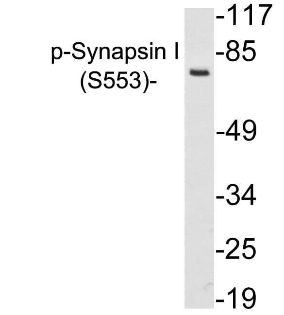 SYN1 / Synapsin 1 Antibody (phospho-Ser553)