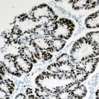 HBP1 Antibody (C-Terminus)