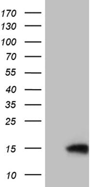 TIMM8A Antibody (clone OTI5C8)