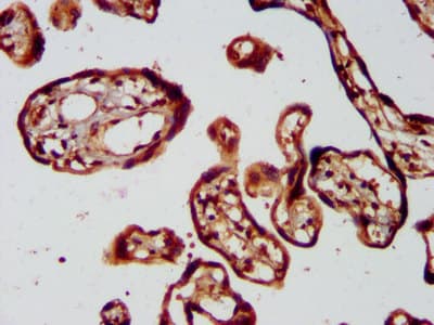 Polyclonal Rabbit anti-Human KIF1BP Antibody (IHC, IF)