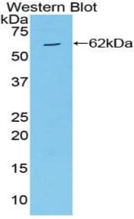 MAP2K4 / MKK4 Antibody (aa137-394)