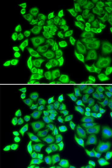 EEF1D Antibody