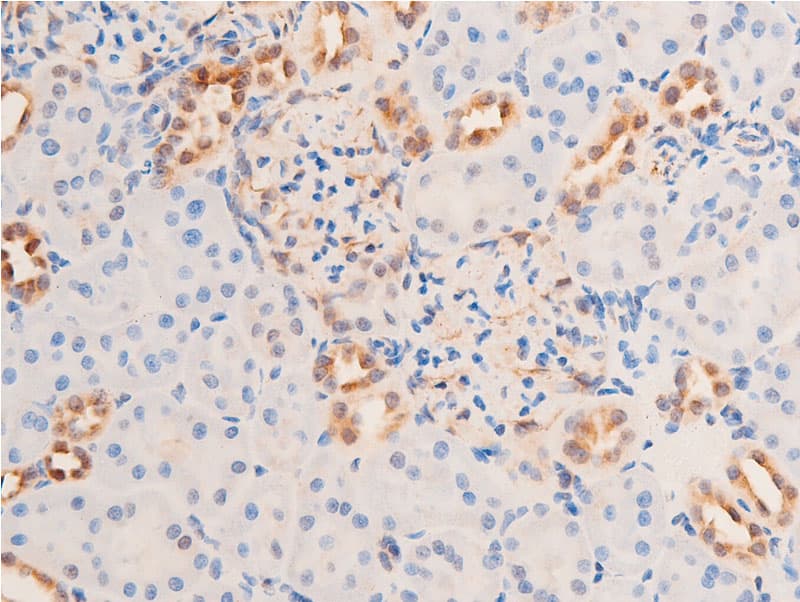 Polyclonal Rabbit anti-Human CHEK1 / CHK1 Antibody (phospho-Ser280, IHC, IF, WB)