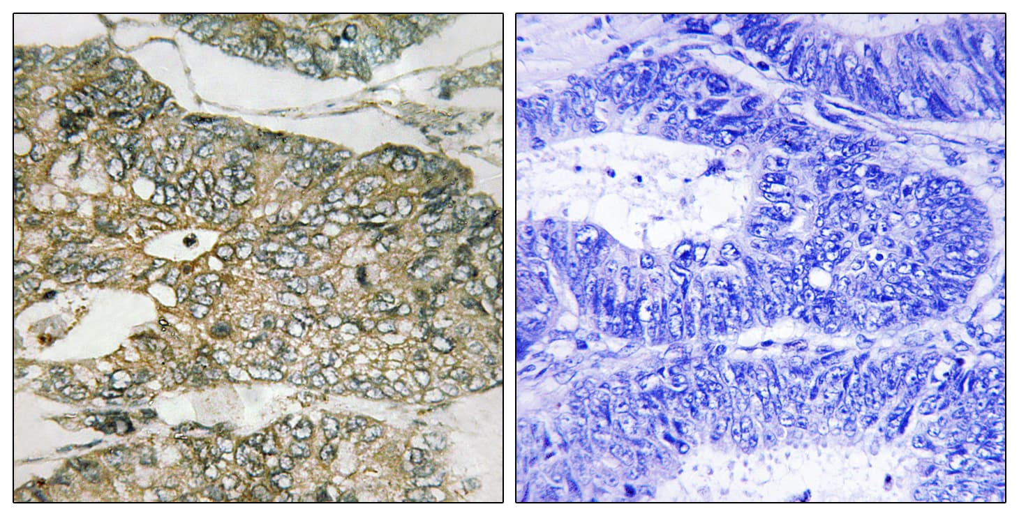 GRB2 Antibody (phospho-Ser159)