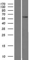 ZNF480 Protein (Over-Expression Lysate Myc-DDK (Flag))