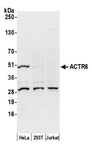 Polyclonal Rabbit anti-Human ACTR6 Antibody (aa1-50, WB)