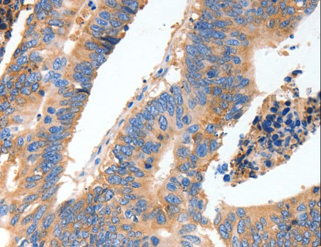 Polyclonal Rabbit anti-Human MUC6 / MUC-6 Antibody (IHC)