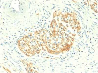 NCAM / CD56 Antibody (clone NCAM1/2217R, Azide-free, Carrier-free)