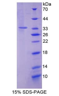Mouse SIRT2 / Sirtuin 2 Protein (Recombinant His-T7)