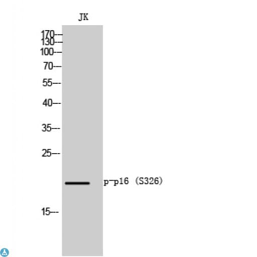 p16INK4a / CDKN2A Antibody