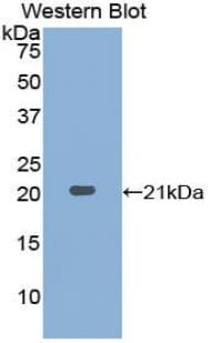 PathPlus™ ACPP / PAP Antibody (aa217-386)