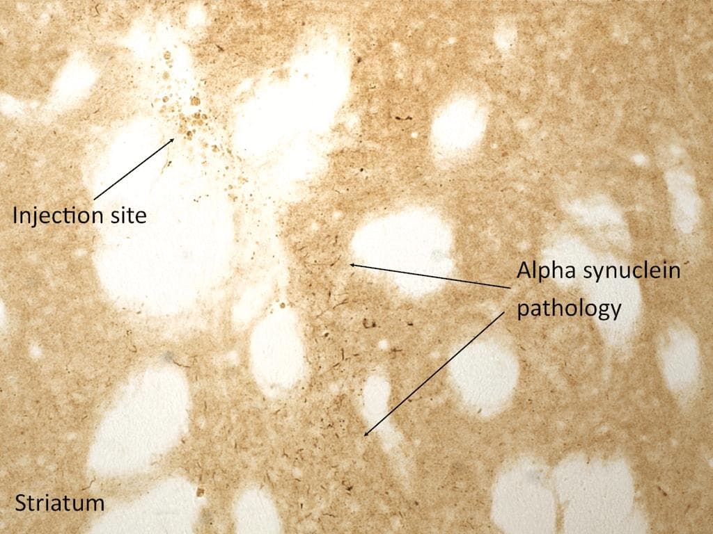 Human SNCA / Alpha-Synuclein Protein (Recombinant)
