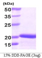 Human STMN1 / Stathmin / LAG Protein (Recombinant His)