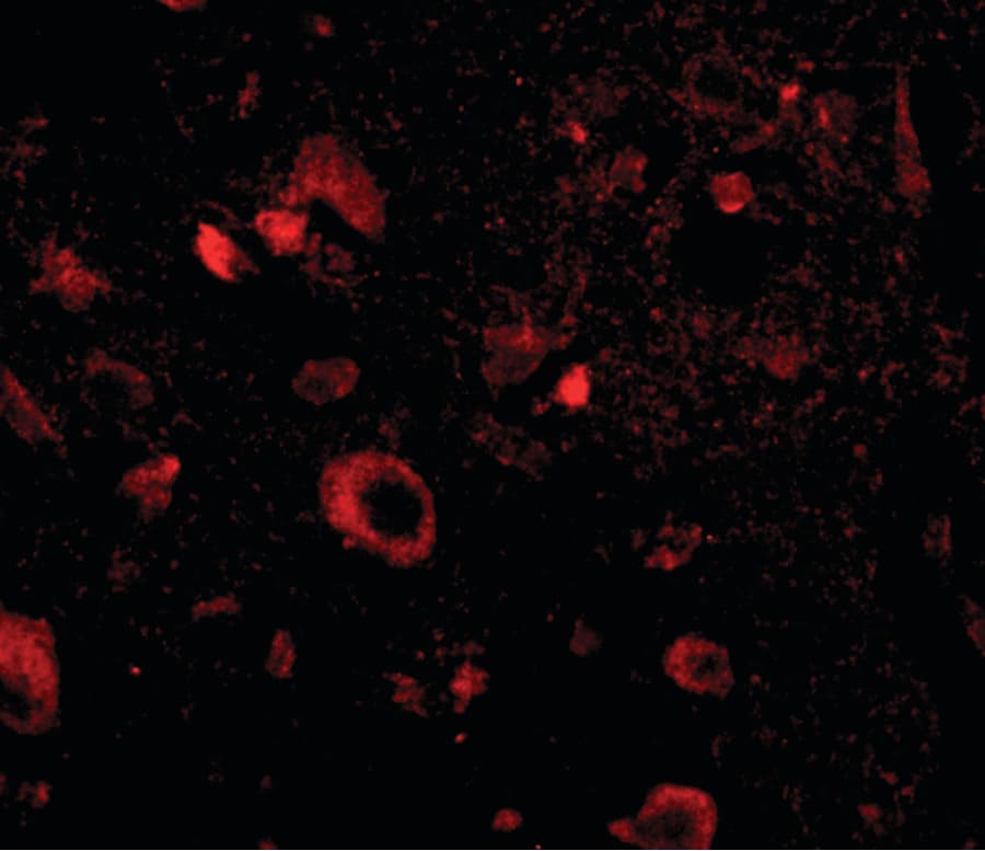 IHC-plus™ Polyclonal Rabbit anti-Human AIPL1 Antibody (IHC, IF, WB)