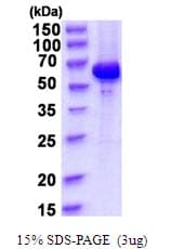 Human AKT1 Protein (Recombinant His)
