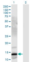 Gastrin Releasing Peptide Antibody (clone 3A11)