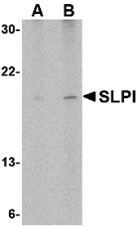 Polyclonal Rabbit anti-Human SLPI / Antileukoproteinase Antibody (IHC, WB)