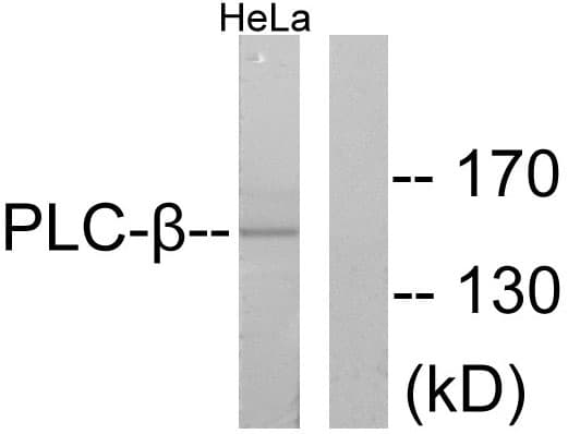 PLCB3 Antibody (aa1071-1120)
