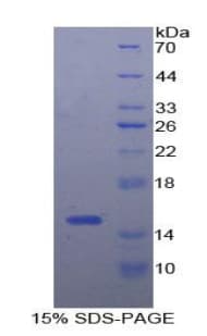 Mouse CXCL10 / IP-10 Protein (Recombinant His-T7)