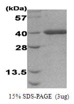 Human AHSA1 / AHA1 Protein (Recombinant)