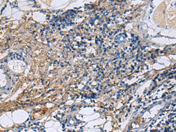 Polyclonal Rabbit anti-Human PROC / Protein C Antibody (IHC)