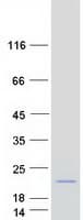 Human HIST1H2BM Protein (Recombinant Myc-DDK (Flag))
