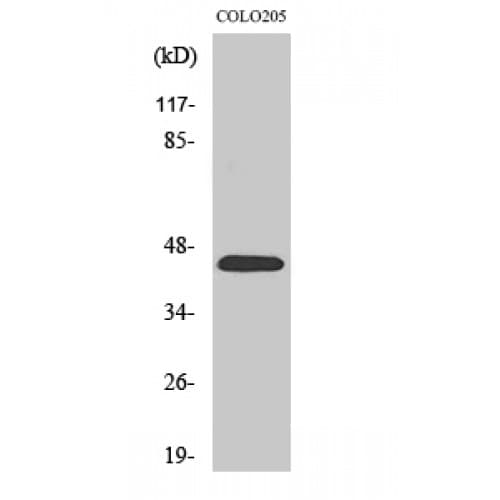 PROKR1 Antibody (30-110 aa, N-terminal)