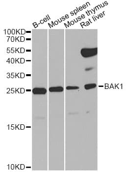 Polyclonal Rabbit anti-Human BAK1 / BAK Antibody (IHC, IF, WB)