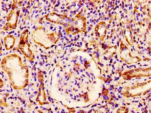 RAB3GAP1 Antibody