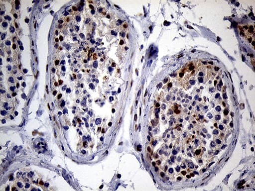 Monoclonal Mouse anti-Human SPANXB1 Antibody (clone OTI1E11, Carrier-free, IHC, WB)