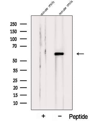 Polyclonal Rabbit anti-Human PPP5C Antibody (WB)