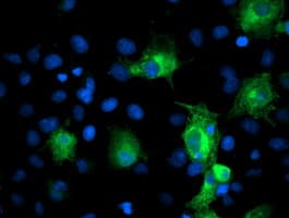 PFKP Antibody (clone OTI1F2)