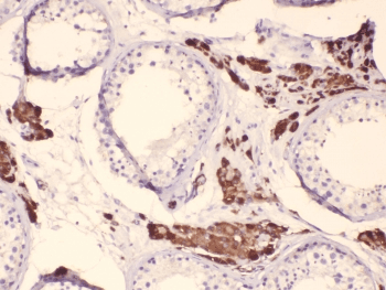 Polyclonal Rabbit anti-Human CYP17 / CYP17A1 Antibody (IHC, WB)