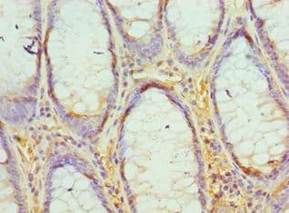 EED Antibody (aa1-300)