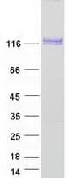 Human DDR2 Protein (Recombinant Myc-DDK (Flag))