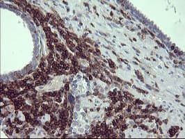 CD45 / LCA Antibody (clone OTI3F2)