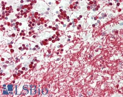 IHC-plus™ CDK5 Antibody (aa11-60)