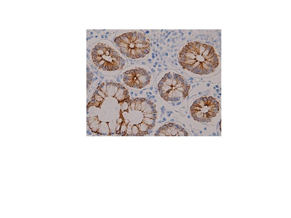 KRT8 / CK8 / Cytokeratin 8 Antibody