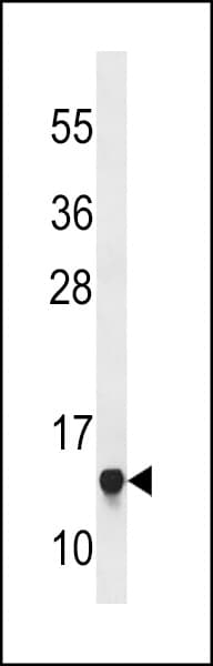 RPS23 / Ribosomal Protein S23 Antibody (aa1-30)