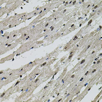 Polyclonal Rabbit anti-Human CTNNB1 / Beta Catenin Antibody (IHC, WB)